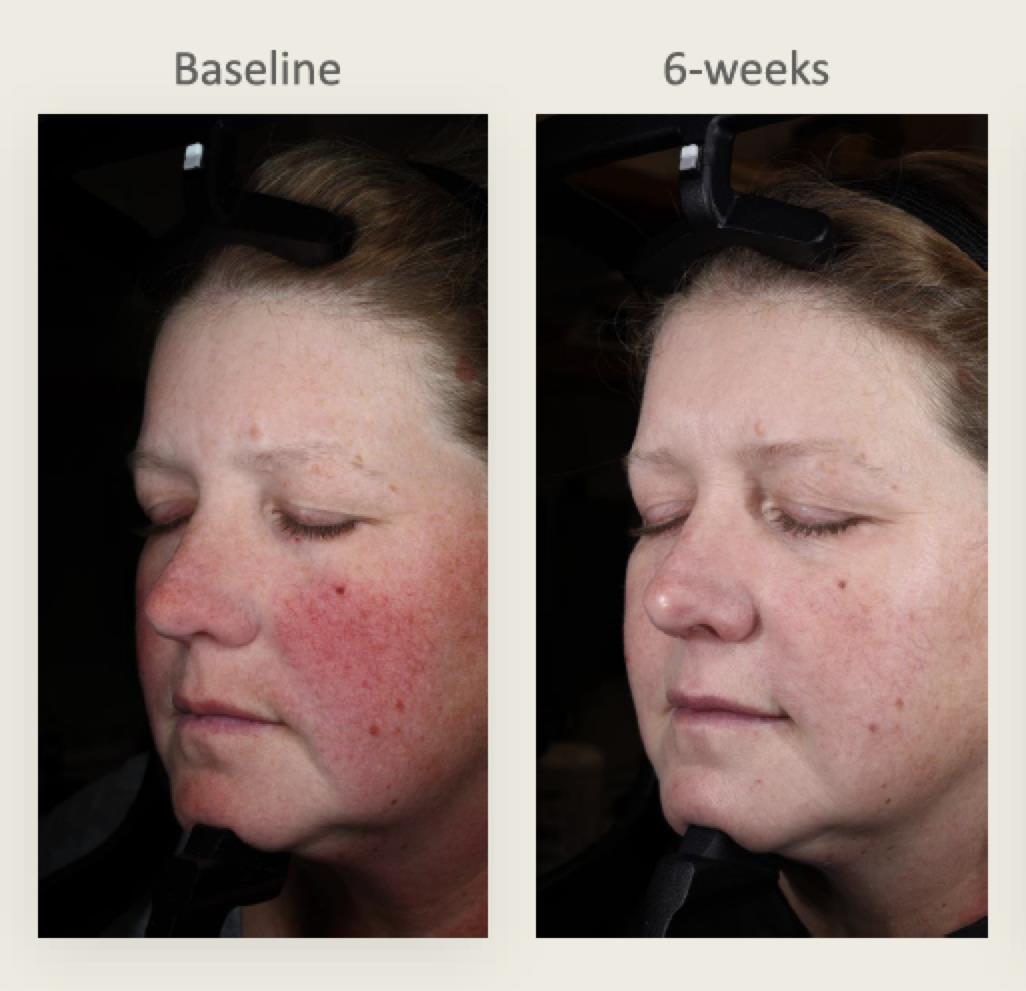 Plated Skin Science: Intense Serum