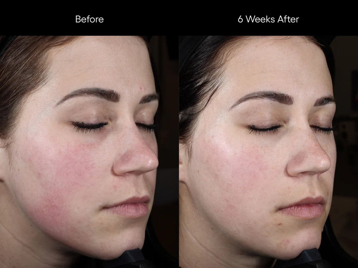 Plated Skin Science: Intense Serum