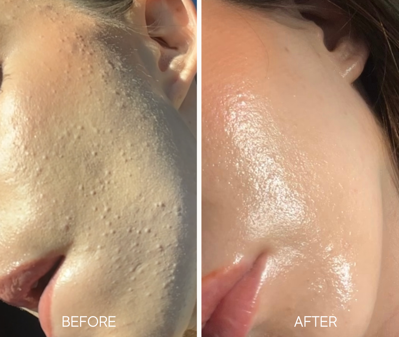 Lumiellé: Glass Skin Liquid Exfoliant