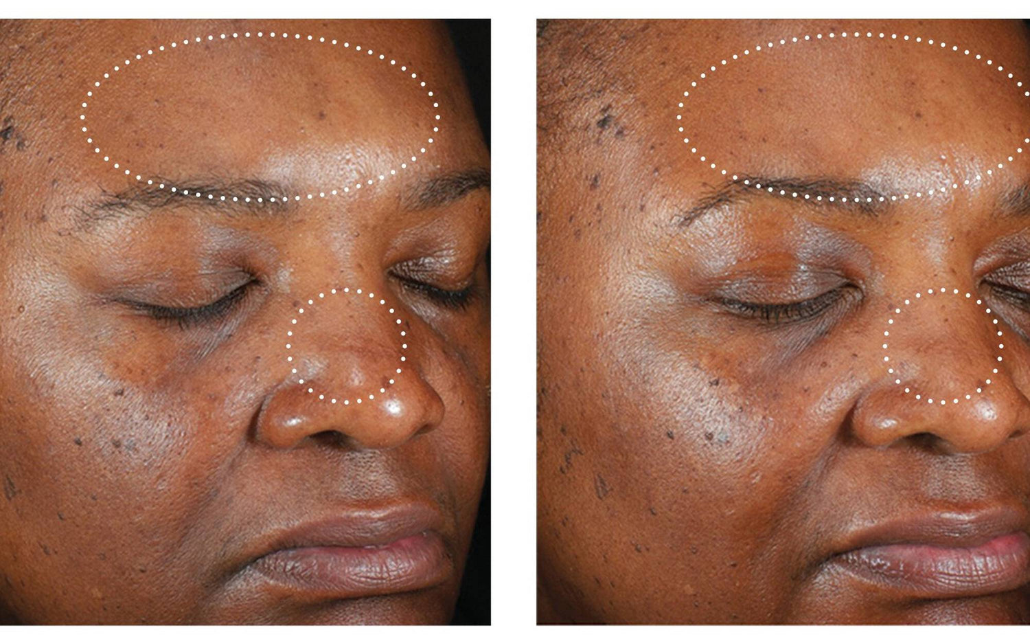 Skin Better Science: Even Intensive Skin Tone Correcting Serum 50 mL **NEW**