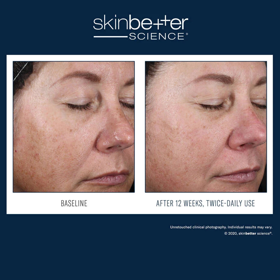 Skin Better: Alto Advanced Defense and Repair Serum