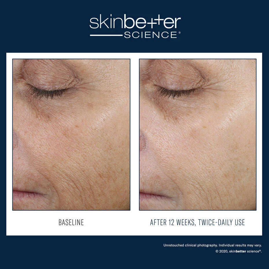 Skin Better Science: Even Tone Correcting Serum 50ml