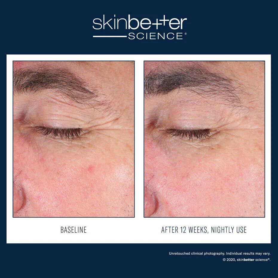 Skin Better Science: EyeMax AlphaRet Overnight Cream 15ml