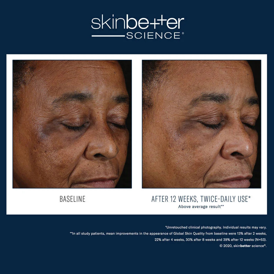 Skin Better Science: Mystro Active Balance Serum 30ml