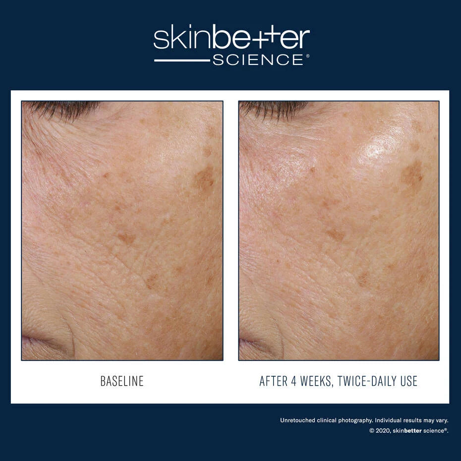Skin Better Science: Trio Rebalancing Moisture Treatment