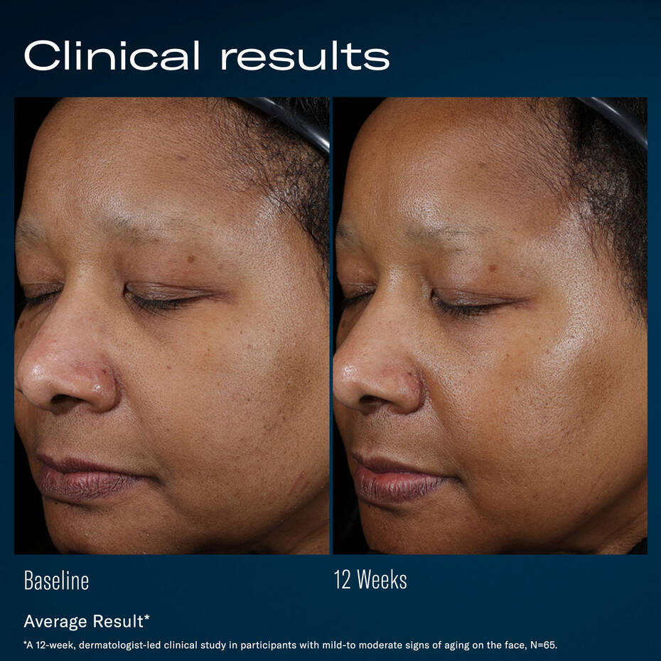 Skin Better: Ampra Volumizing Macro HA Serum