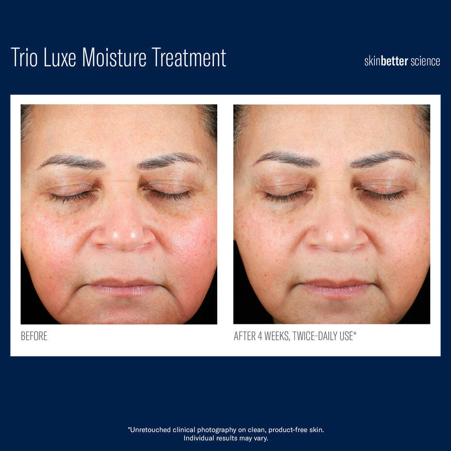 Skin Better Science: Trio Luxe Moisture Treatment 50ml