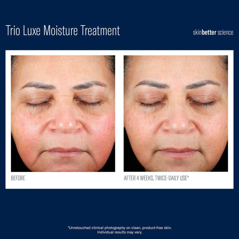 Skin Better Science: Trio Luxe Moisture Treatment