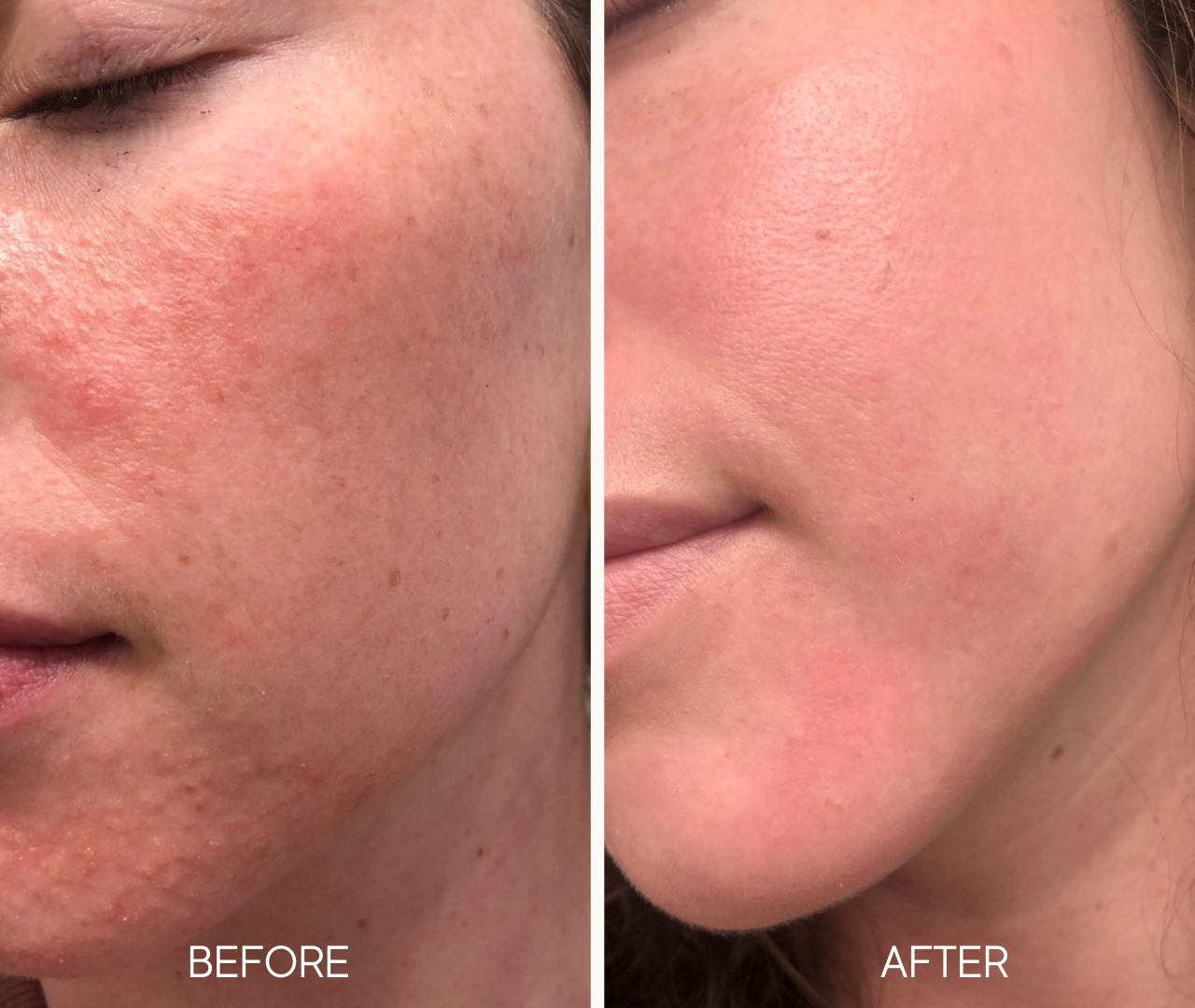 Lumiellé: Glass Skin Liquid Exfoliant