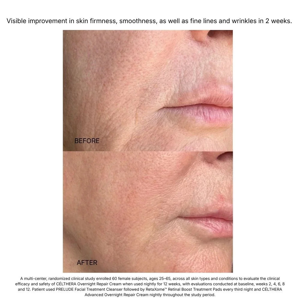 Hydrinity: Célthera Advanced Overnight Repair Cream