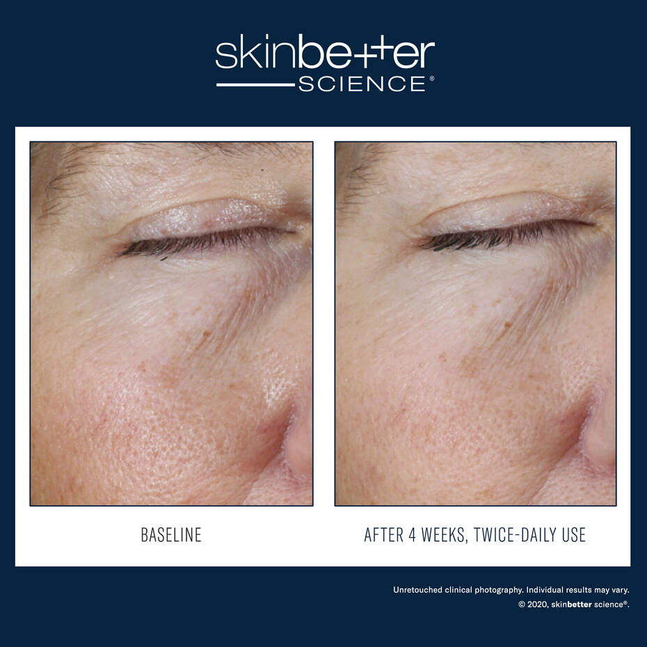 Skin Better Science: Instant Effect Gel EYE