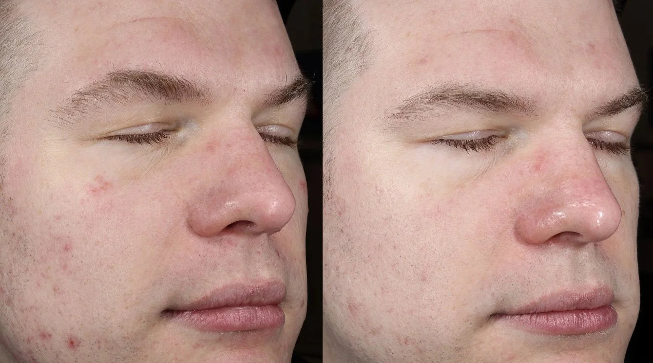 Plated Skin Science: Intense Serum