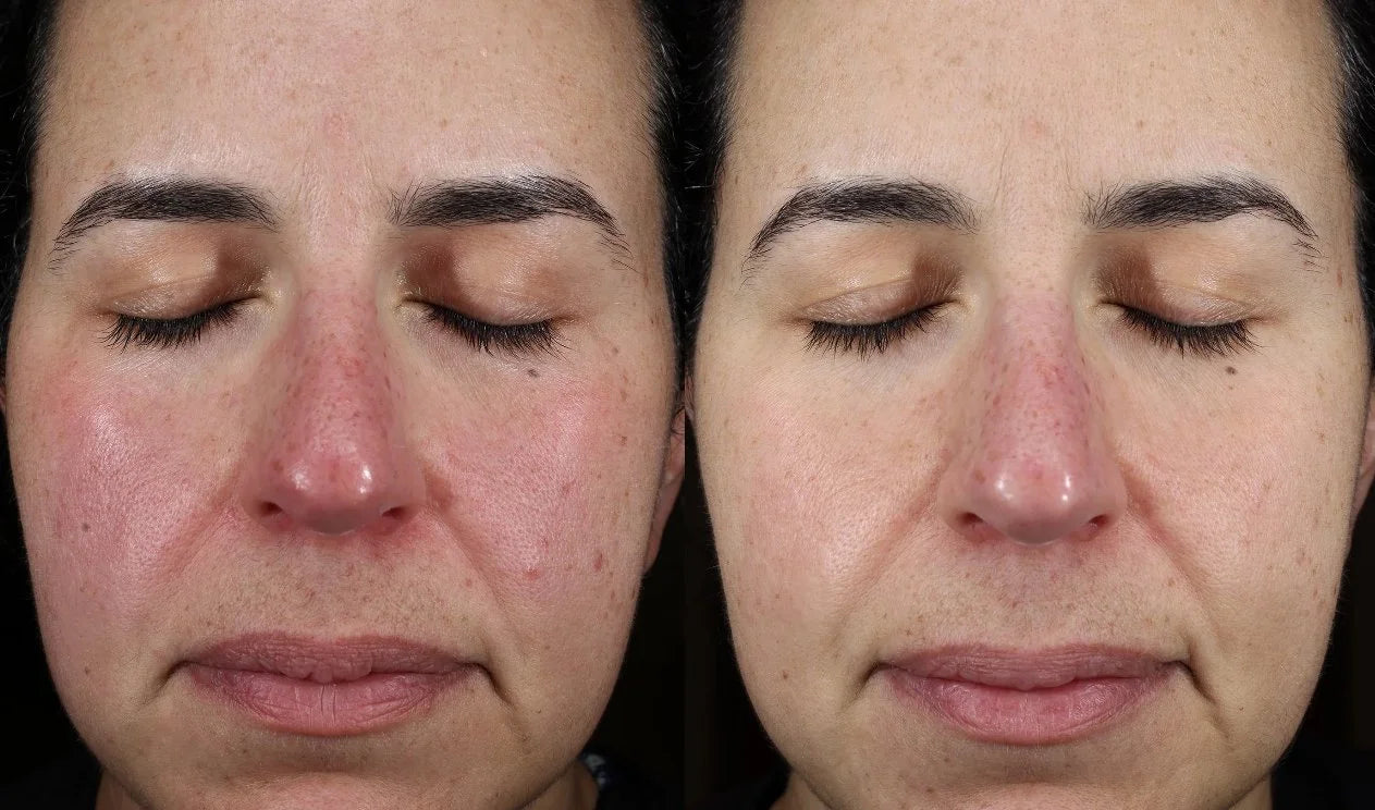 Plated Skin Science: Intense Serum